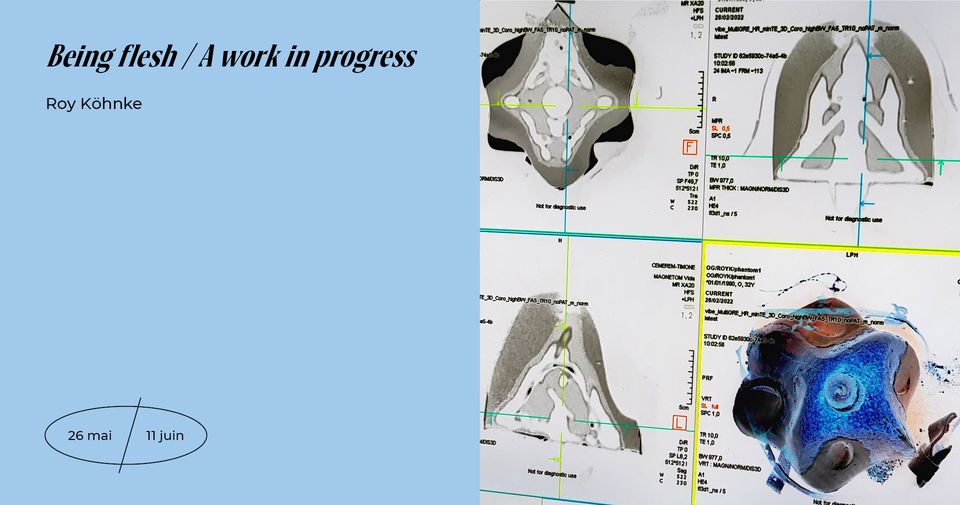 Being flesh / A work in progress – Vernissage